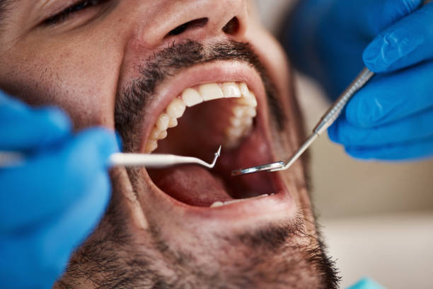 Best Tooth Infection Emergency Dentist  in Newkirk, OK